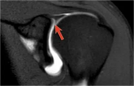 Раменна става анатомия използване проучване MRI