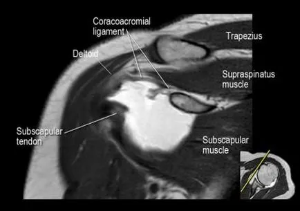 Раменна става анатомия използване проучване MRI