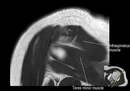 Раменна става анатомия използване проучване MRI