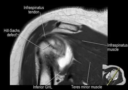 Раменна става анатомия използване проучване MRI