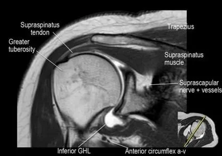 Раменна става анатомия използване проучване MRI