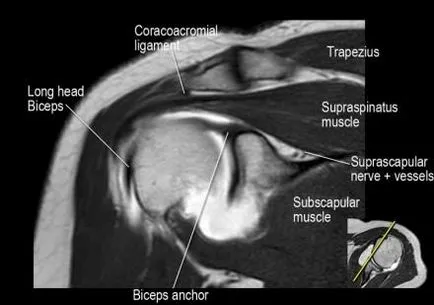 Раменна става анатомия използване проучване MRI