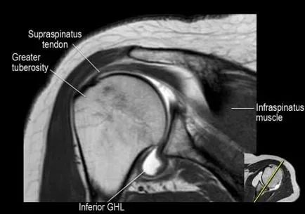 Раменна става анатомия използване проучване MRI