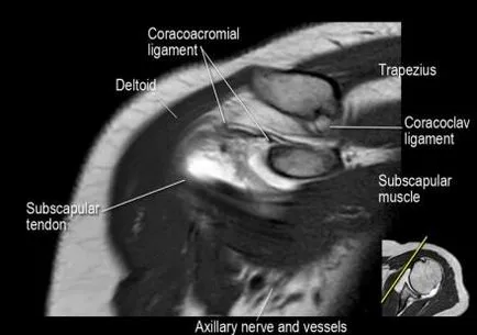 Раменна става анатомия използване проучване MRI