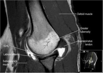 Umăr anatomie studiu comun folosind IRM