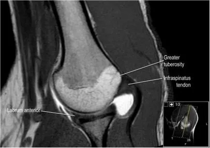 Раменна става анатомия използване проучване MRI