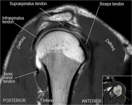 Раменна става анатомия използване проучване MRI