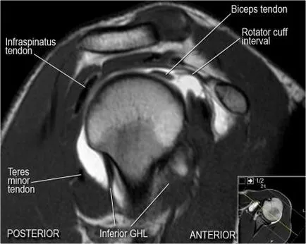 Раменна става анатомия използване проучване MRI