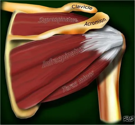 Umăr anatomie studiu comun folosind IRM