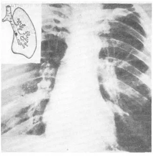 Tüdőrák klinika onkológiai diagnosztika