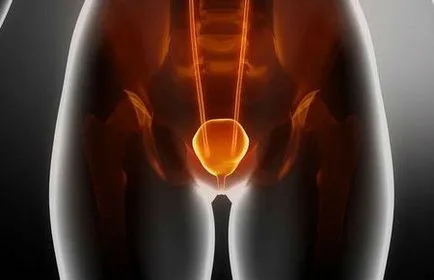 Ruptură a vezicii urinare, dacă ar putea izbucni, efecte, simptome