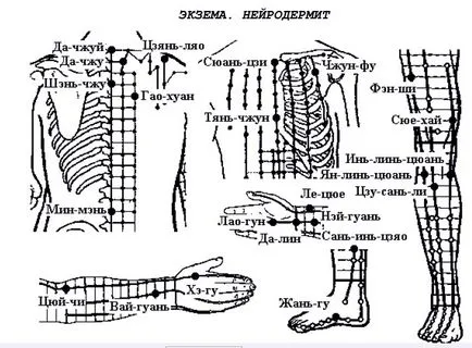 reflexológia neurodermitis