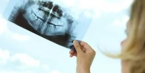 dentare raze X în timpul sarcinii - dacă este posibil să se ia o fotografie în stadiile incipiente