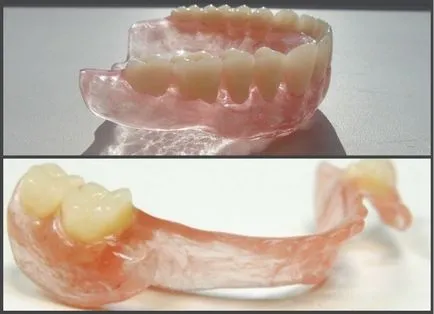 Протези akri склад снимка, ревюта и цени