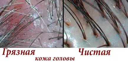 Scrub Hair - Sampon - scalpului