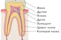 Consolidarea dinților și gingiilor remedii populare