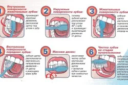 Consolidarea dinților și gingiilor remedii populare