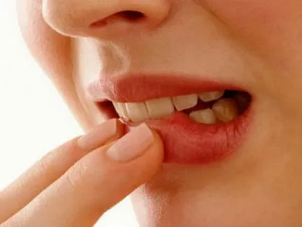 Видове зъбни патологии и контролни антибиотици с заболяване на венците и кариес и народната