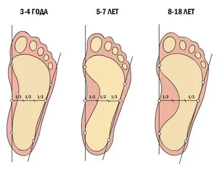 Как да се предпазим плоски крака на дете