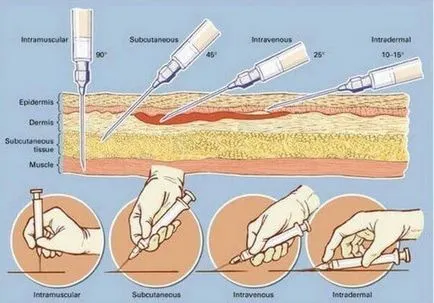 Cum de a face preparate injectabile, întotdeauna în formă!