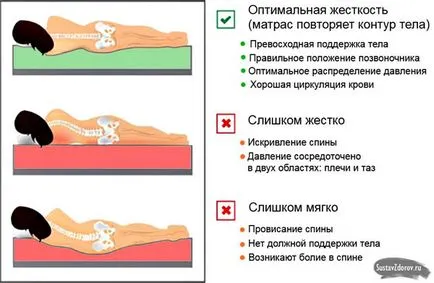 Cum de a dormi în osteocondrozei (de col uterin și a altor) reguli importante