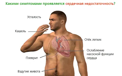 Кардиология - Медицински център Здраве