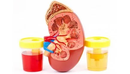 Clasificarea glomerulonefrita mesangioproliferativă, membranoase, etc.