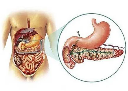 Atunci când o operațiune este atribuită în pancreas și pancreatită, care are efecte