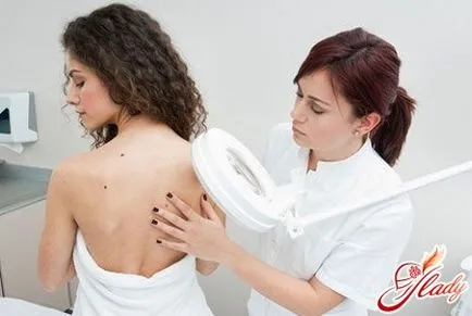 Melanoma bőrtünetek és a betegség tüneteit