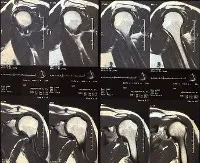 MRI a vállízület - az árak Moszkvában talált 274 árak