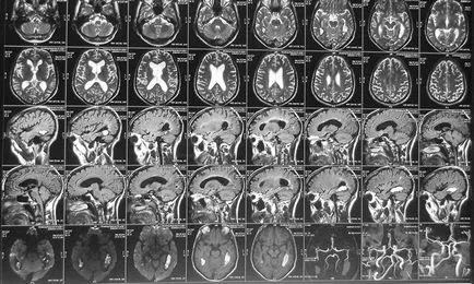 MRI на мозъка в CJSC в нашата диагностичен център