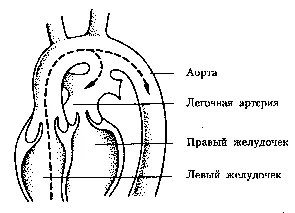 Cleft artériás légcsatorna