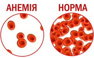 Дихлоретан симптомите на отравяне, оказване на първа помощ