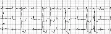 Paired bate cauze, diagnostic si tratament