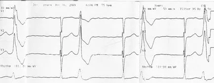 Paired bate cauze, diagnostic si tratament