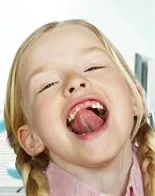 Пластмасови юзда език при деца
