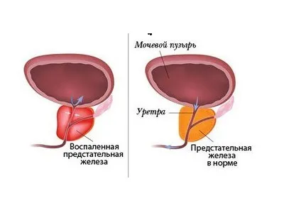 Размерите на простатната жлеза е нормално на ултразвук изчисляване на линейни показатели, изчисляването на обем и маса