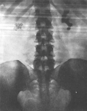 X-ray vizsgálati módszerek