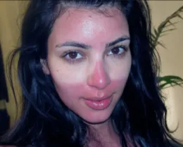 Слънчево изгаряне на лицето й - от лек - процедури за лице