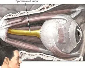 O metodă pentru tratarea optic atrofia nervului etiologii diverse