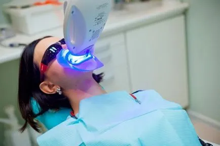 Стоматологична клиника ООД стома Волгоград - избелване на зъбите