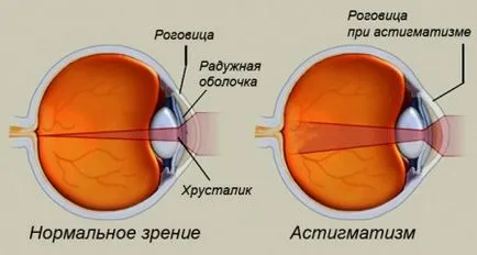 Тестът за астигматизъм независимо провери зрението