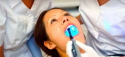 Metode de consolidare a smalțul dinților, sfaturi