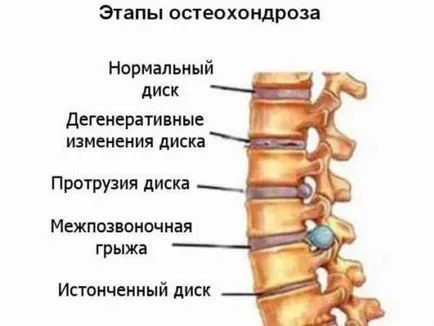 Чигонг упражнения за гръбначния стълб и обратно видеото