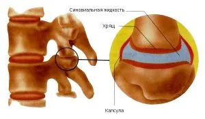 Krónikus hátfájás