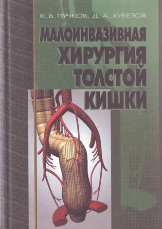 Хирургично лечение на дивертикулит на дебелото черво - уникални методи на лапароскопска хирургия -