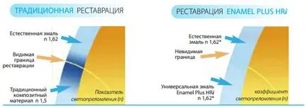 Описание В, естетически възстановяването на зъби материал композитен емайл плюс