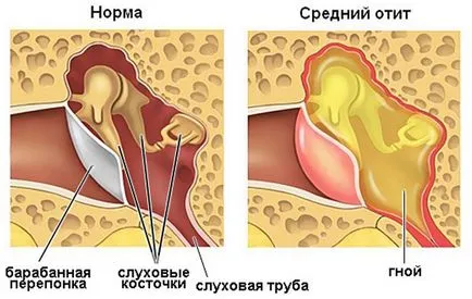 A gyalogok fülek magas vagy alacsony nyomáson (légköri vagy vér)