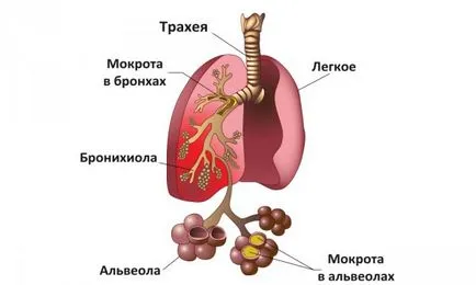 Cât de periculos praf bronșită și cum să identifice