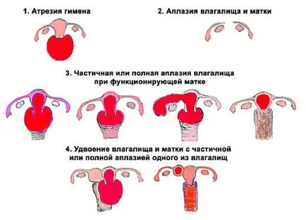 Колко опасен хипертонични на матката по време на бременност